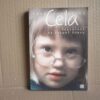 Cela - odpowiedź na zespół Downa - Anna Sobolewska